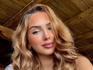 Foto Miss Austria yang Meninggal di Usia 22, Punya Riwayat Penyakit Jantung