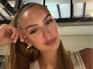 Miss Austria Meninggal di Usia 22 Tahun Saat Masih Menjabat