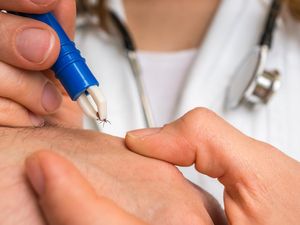 Ngeri, Ilmuwan China Temukan Virus Baru yang Ditularkan Kutu
