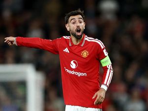 Duh, Bruno Fernandes Terpincang-pincang