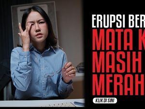 Erupsi Berlalu, Kok Mata Masih Merah? Ini Kemungkinannya Menurut Dokter Mata