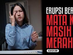 Erupsi Berlalu, Kok Mata Masih Merah? Ini Kemungkinannya Menurut Dokter Mata