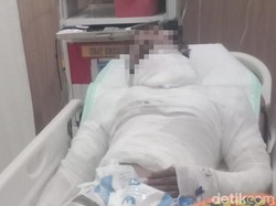 Sopir Truk di Bali Dibakar Bos gegara Setoran, Korban Luka Serius