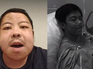 Viral Kisah Pria Jakbar Cuci Darah Sejak Usia 16 Tahun, Ternyata Ini Penyebabnya