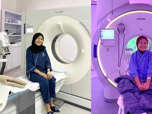 Viral Kisah Wanita Tangerang Idap Kanker Ovarium di Usia 30-an, Ini Gejalanya