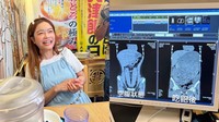 Bikin Merinding, Lambung Bintang Mukbang Taiwan Membesar Bak Balon Air