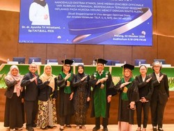 Lulus S3 dengan IPK 4, dr Ayunita Teliti Jahe Merah untuk Redakan Rinitis Alergi
