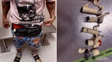 Menyembunyikan Sepuluh Burung di Balik Pakaian: Kronologi Kecurangan Turis di Bandara Miami
