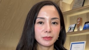 Langkah Kirana Larasari Usai Terseret Dugaan Penipuan Emas Rp 25 M