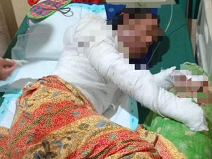 Istri yang Dibakar Suami di Lampung Ternyata Sedang Hamil, Motif Diselidiki