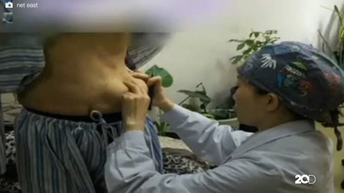 Loh? Payudara Wanita Ini Pindah ke Perut