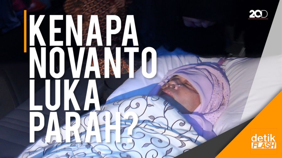Bagaimana Bisa Novanto Luka Parah tapi Sopirnya Tidak?