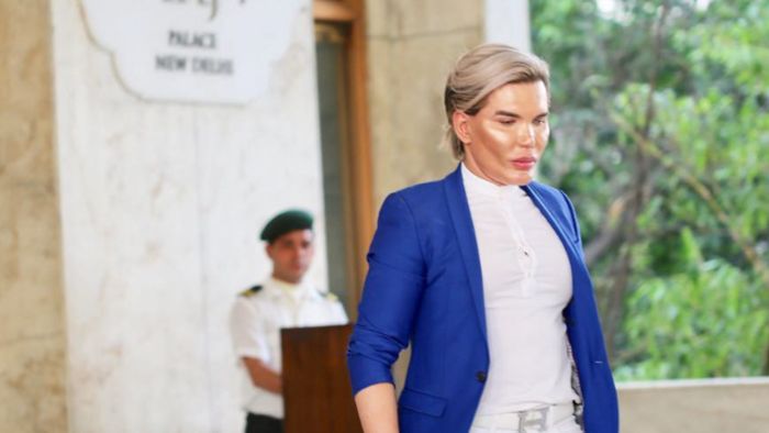 Demi Mirip Boneka Ken, Pria Ini Operasi Plastik 58 Kali