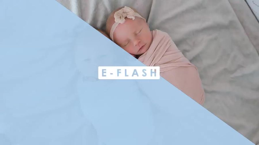 Cerita Sedih di Balik Foto Bayi Kembar Ini