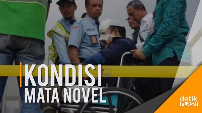34 Hari Kondisi Novel Pasca Teror Air Keras