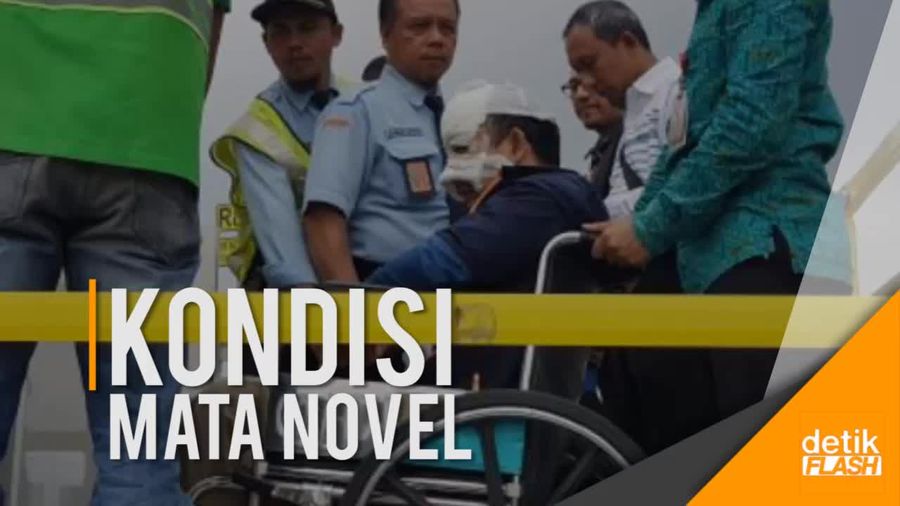 34 Hari Kondisi Novel Pasca Teror Air Keras