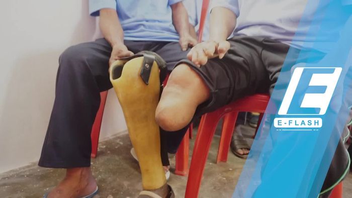 Pak Jokowi, Eks Penderita Kusta Ini Butuh Bantuan
