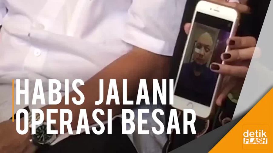 Sang Istri Beberkan Kondisi Terkini Novel Baswedan