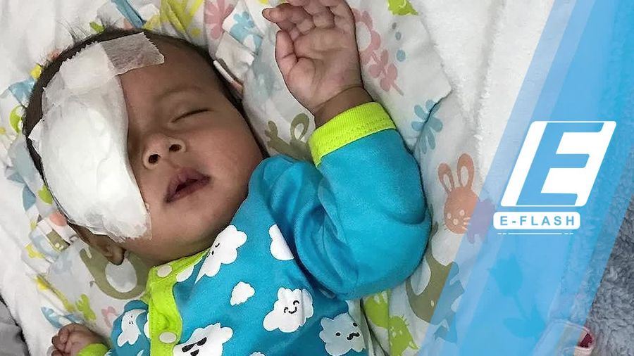 Curhat Asri Welas Soal Bayinya yang Terkena Katarak