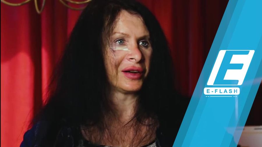 Duh! Aktris Ini Suntikkan Bakteri ke Tubuh Demi Awet Muda