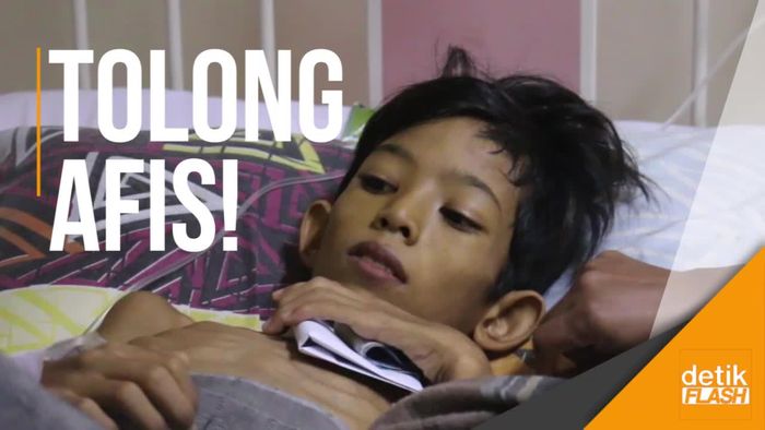 Derita Afis, Si Yatim Pengidap Kelainan Hati dan Gizi Buruk