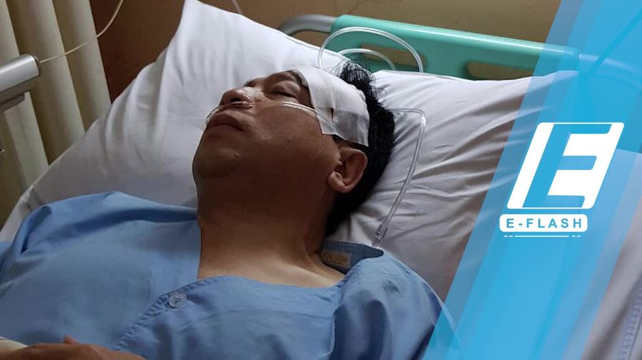 Tompi Janggal dengan Perban Setya Novanto
