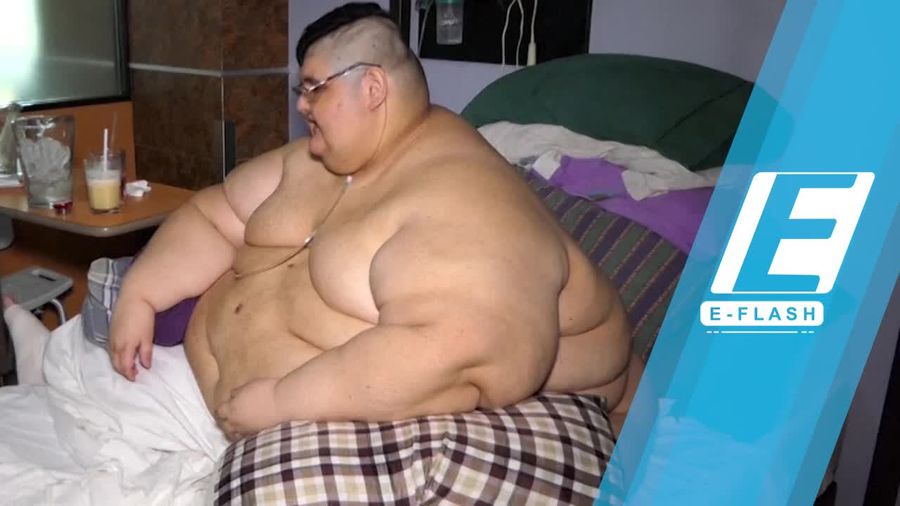 Terberat di Dunia, Pria Ini Obesitas Sampai 595 Kg