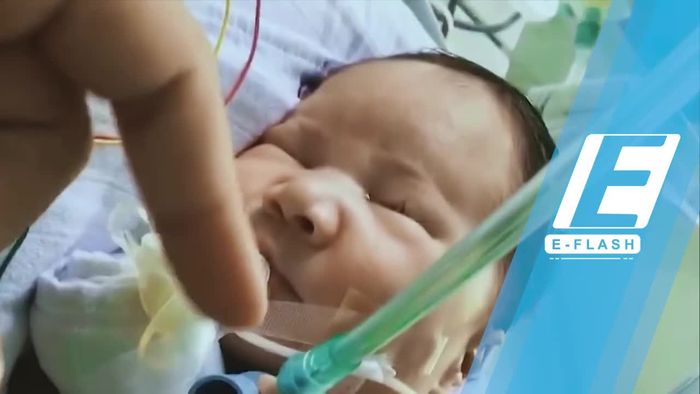 Bawakan Lagu Melawan Dunia, RAN Kirim Doa untuk Adam Fabumi