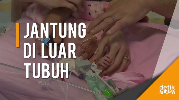 Menyentuh! Kisah Bayi Bertahan Hidup dari Kondisi Langka