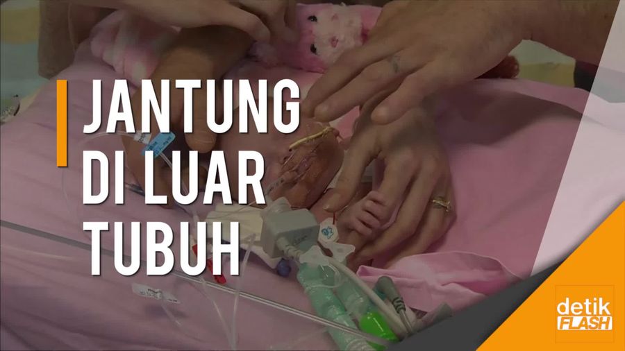 Menyentuh! Kisah Bayi Bertahan Hidup dari Kondisi Langka