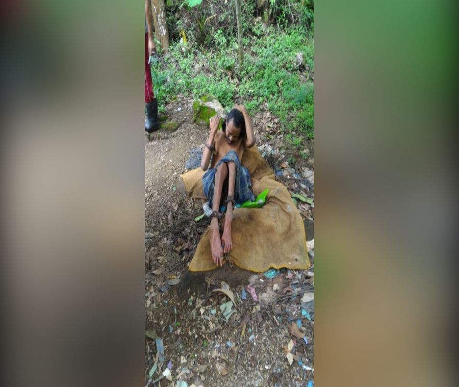 Kisah Rusman yang 25 Tahun Dipasung di Hutan