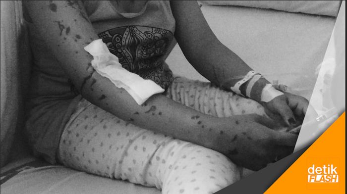 Cerita Ibu Korban Aksi Penyerangan Air Keras di Klender