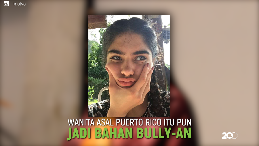 Di-bully Karena Punya Alis Shin Chan, Gadis Ini Kini Jadi Model Terkenal