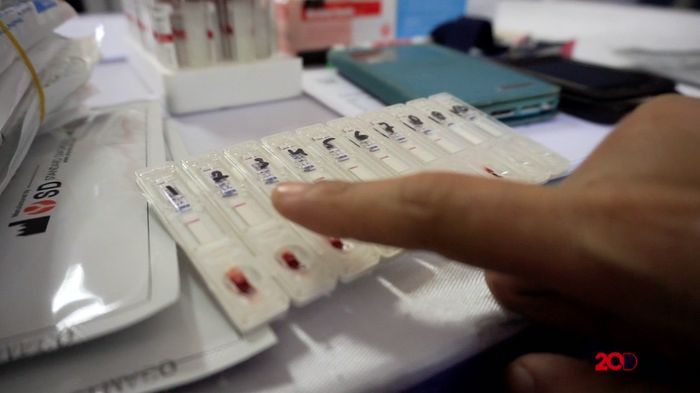 Memperingati Hari AIDS Sedunia, Tes HIV Itu Mudah Lho 