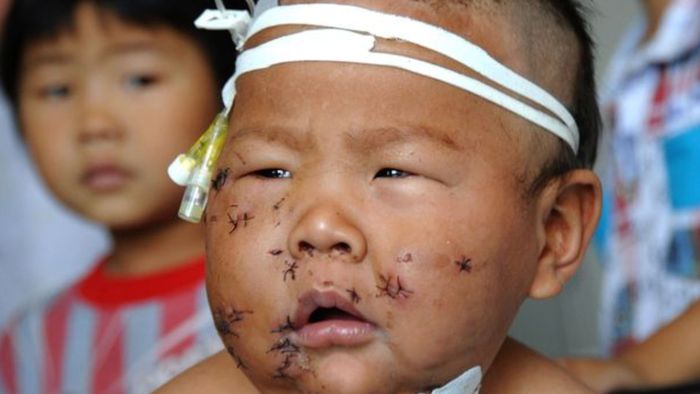 Seorang Ibu di China Tusuk Bayinya Saat Menyusui