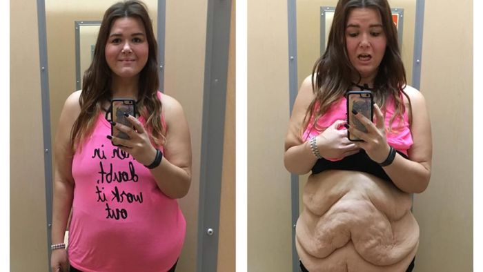 Foto Wanita Pamer Perut Bergelambir Ini Jadi Viral