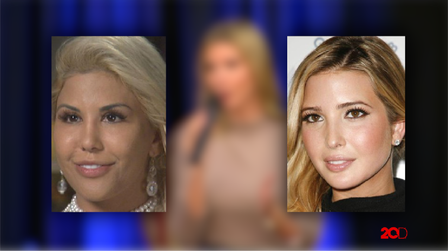 Demi Mirip Ivanka Trump, Wanita Ini Habiskan Rp 1 M untuk Operasi Plastik