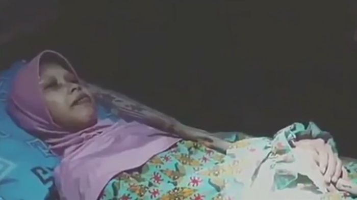 Badan Sulami Jadi Kaku Gara-gara Penyakit Langka