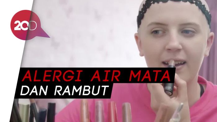 Wanita Ini Alergi Air Mata dan Rambutnya Sendiri