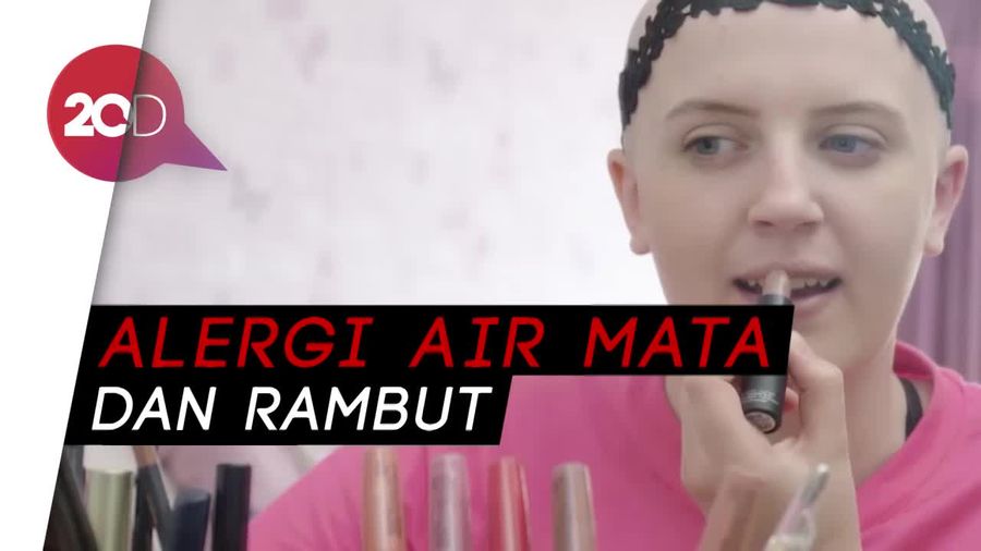 Wanita Ini Alergi Air Mata dan Rambutnya Sendiri