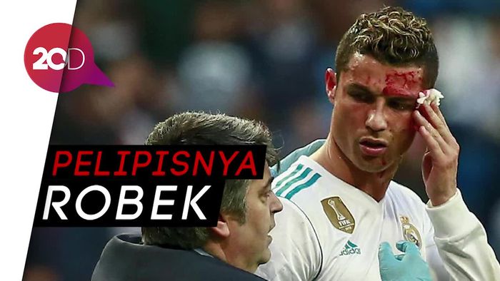 Momen Ronaldo Bersimbah Darah Saat Mencetak Gol
