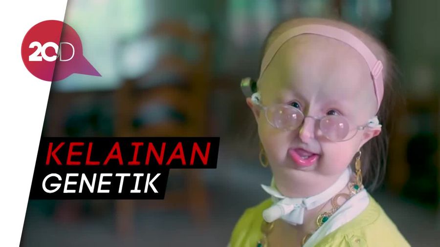 Wanita 20 Tahun Ini Terjebak di Tubuh Anak-anak