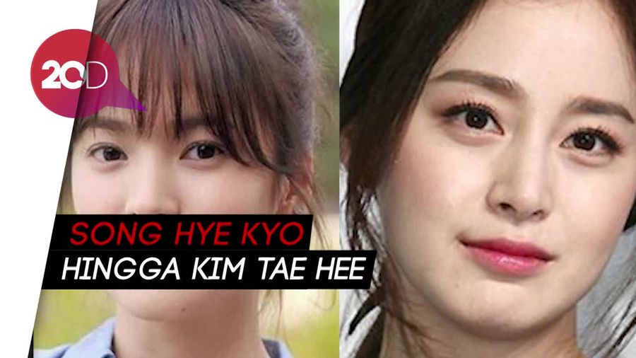 Deretan Artis Korea yang Cantik Alami Tanpa Operasi