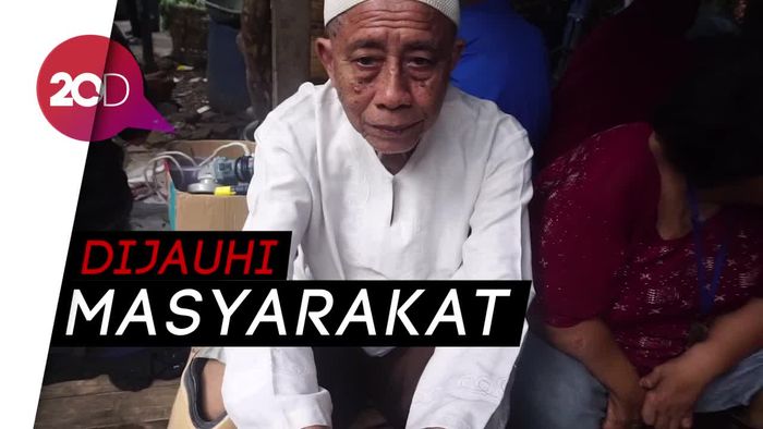 Kusta Tak Menghalanginya Jadi Guru dan Kepala Sekolah
