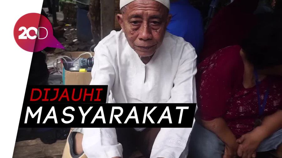 Kusta Tak Menghalanginya Jadi Guru dan Kepala Sekolah