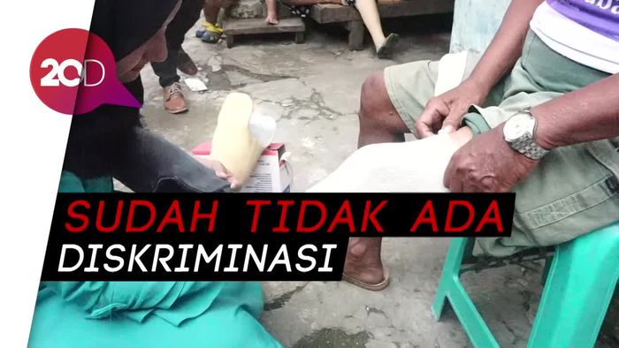 Kampung Kusta yang Tak Lagi Didiskriminasi