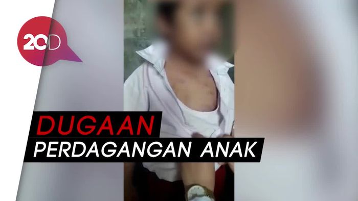 Ada Dugaan Tindak Pidana, Polisi Usut Penganiaya Bocah SD
