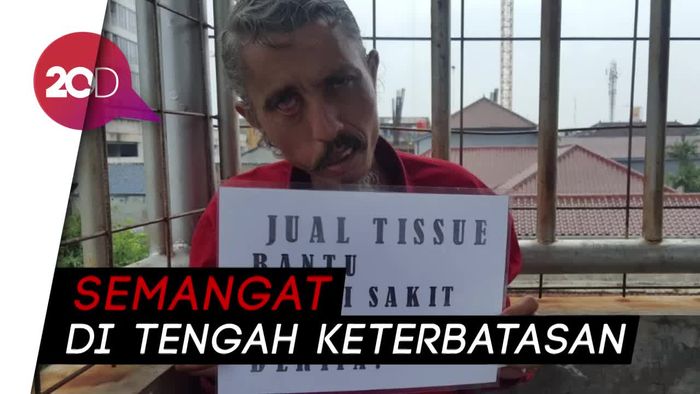 Alami Bells Palsy, Deden Memilih Jualan Tisu Ketimbang Ngemis