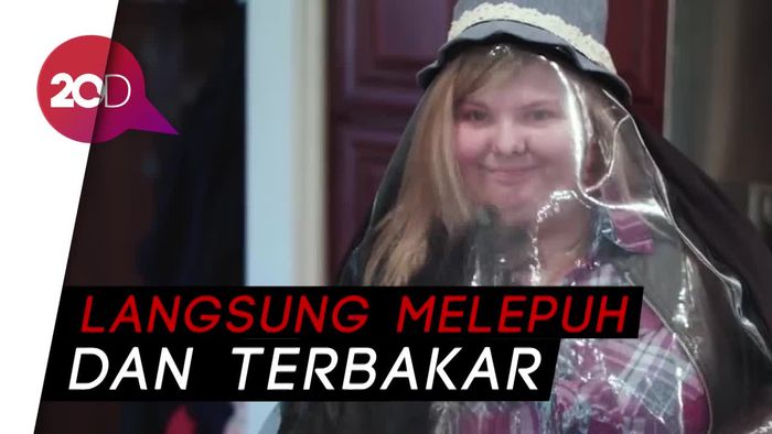 Seperti Vampir, Gadis Ini Alergi Terhadap Matahari