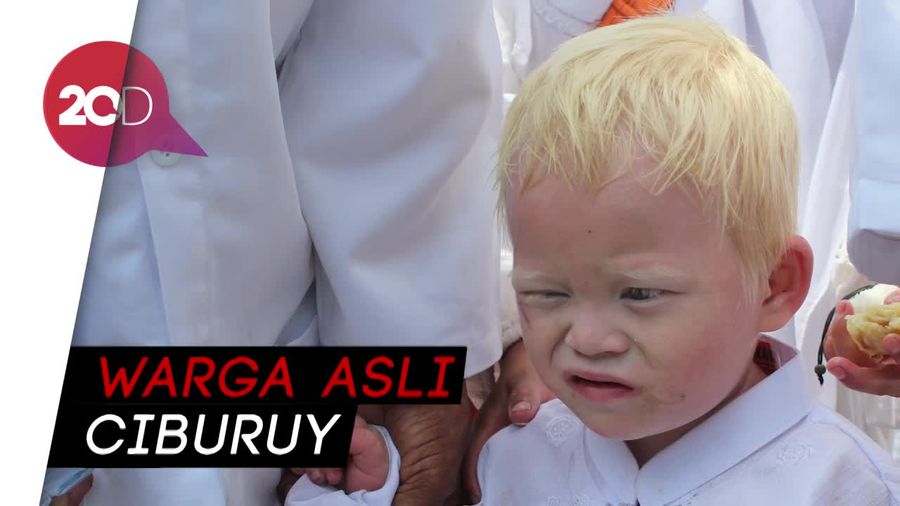 Di Garut Ada Perkampungan Warga yang Dihuni Manusia Albino